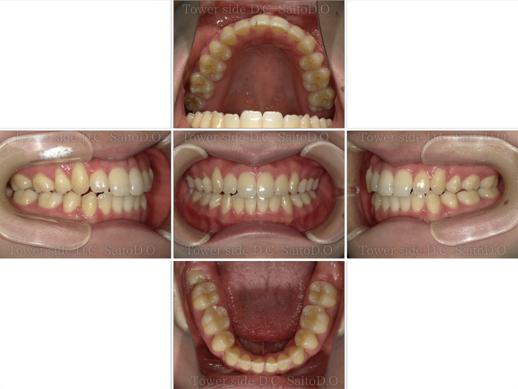 症例（施術後）