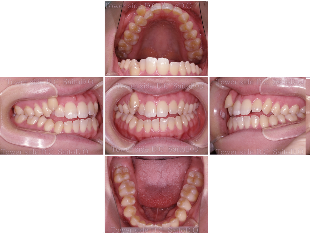 症例（施術前）