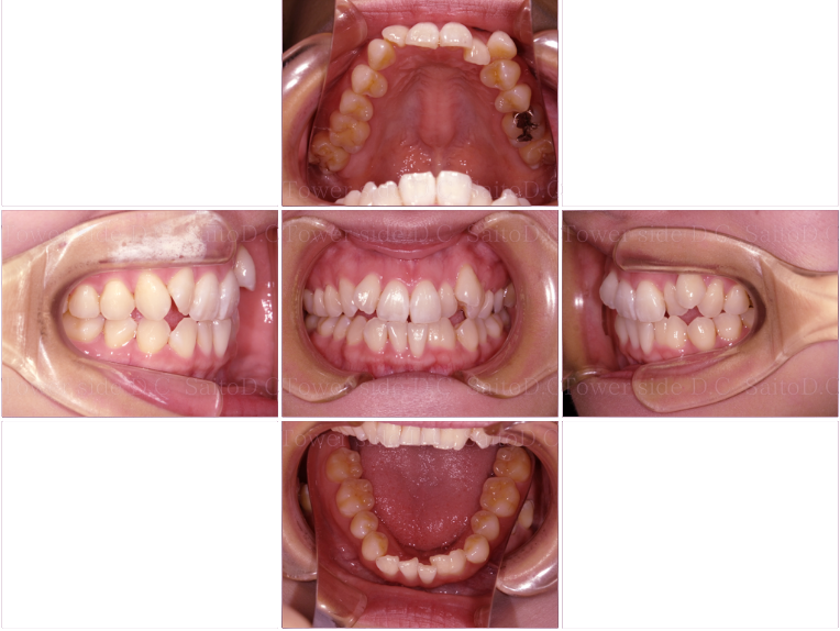 症例（施術前）