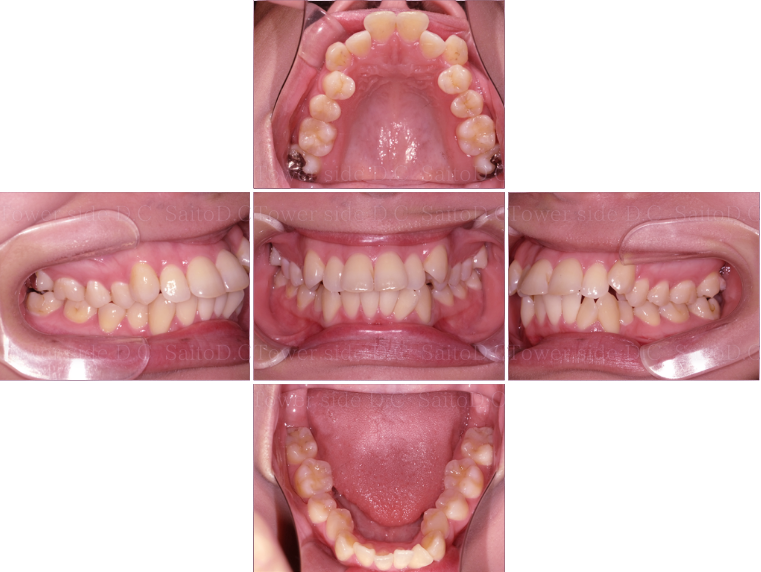 症例（施術前）