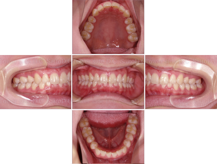 症例（施術後）