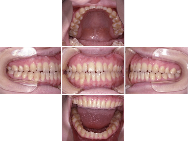 症例（施術前）