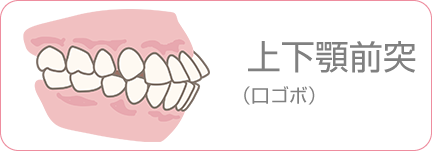叢生（でこぼこ）