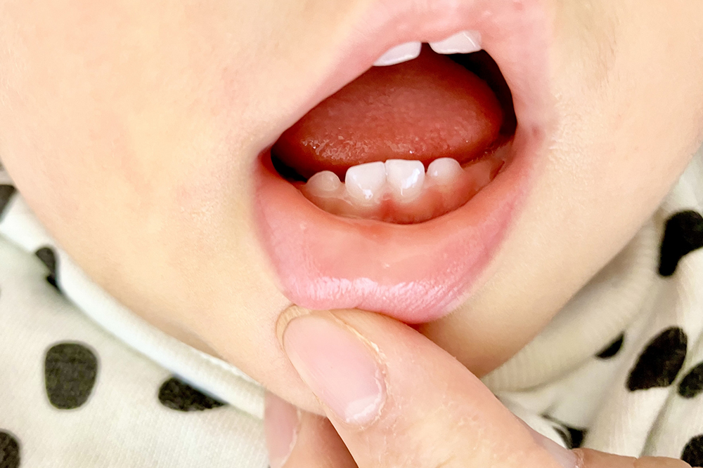 こどもの歯並び