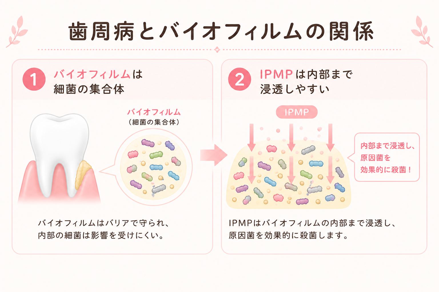 歯周病とバイオフィルムの関係